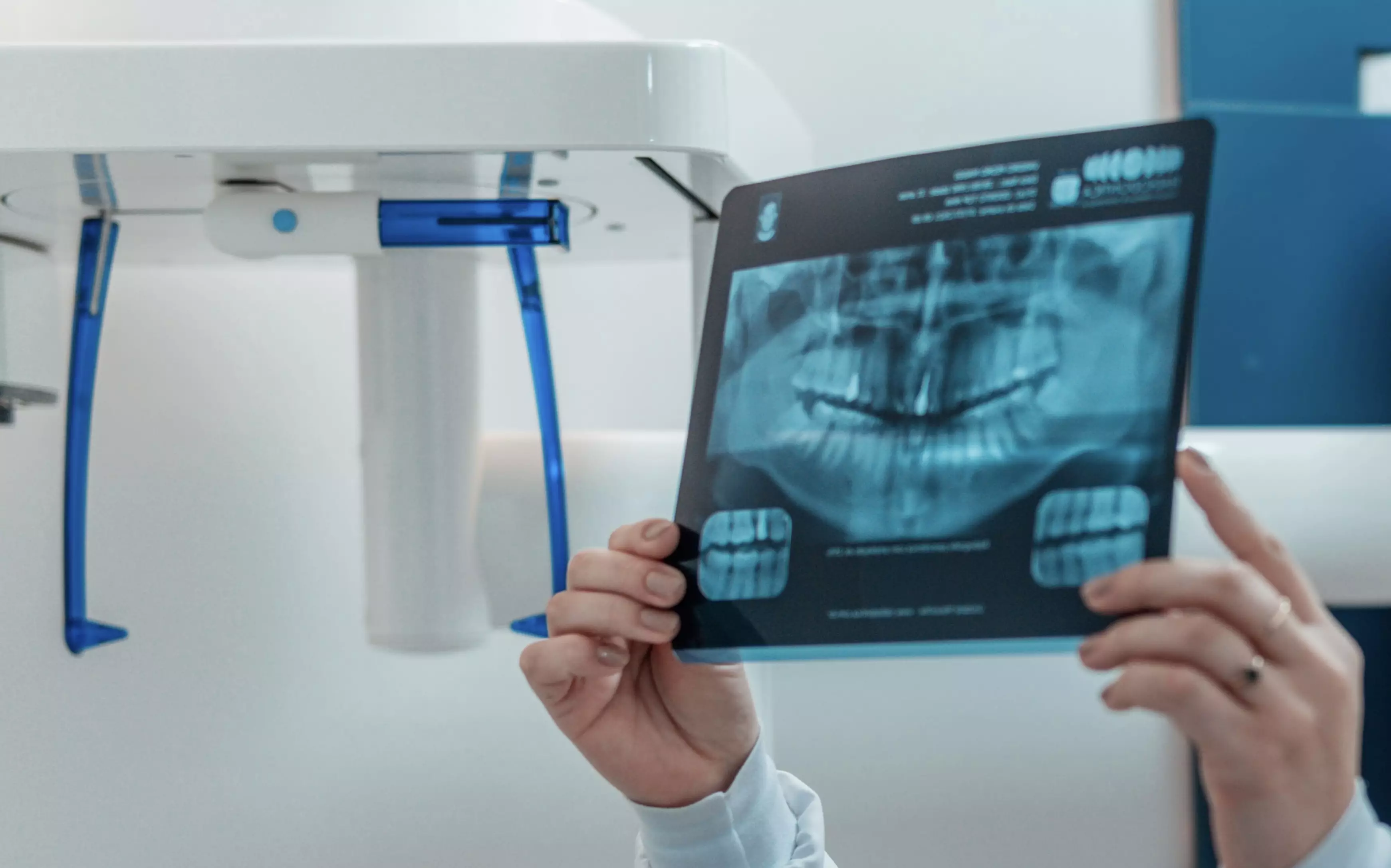 Por que ter um raio-x panorâmico faz total diferença no atendimento odontológico?